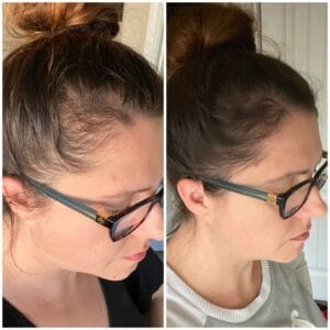 Before & After