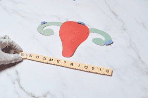 Endometriosis