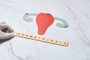 Female uterus with endometriosis, female wellness care concept